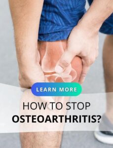 OBESITY AND OSTEOARTHRITIS