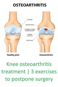 OBESITY AND OSTEOARTHRITIS