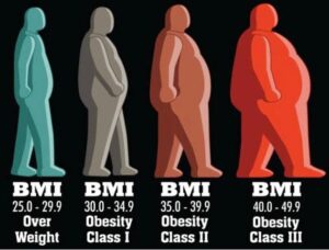 OBESITY AND LOW BACK PAIN (LBP)